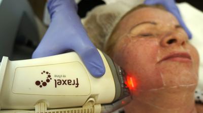 Лазерные аппараты в косметологии: must have для каждой успешной клиники