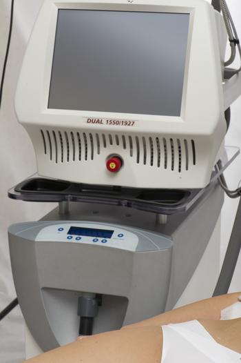 Паломар или Фраксель – аппараты для неаблятивного фототермолиза