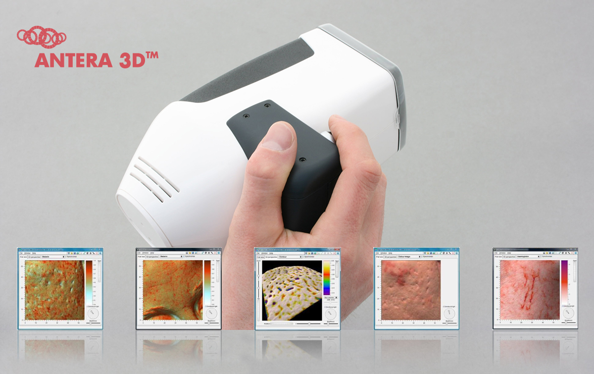 Сравнение двух устройств визуализации и анализа кожи: VISIA® от Canfield и ANTERA 3D® CS от Miravex