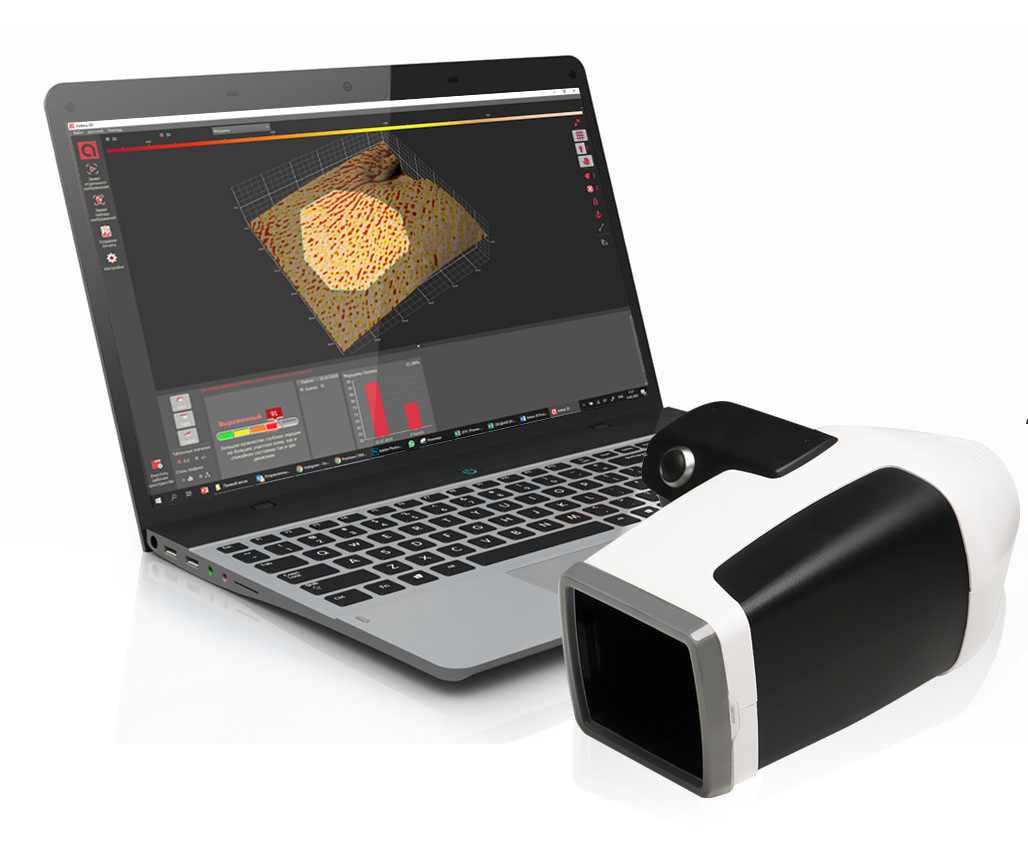 Мнение эксперта: чем аппарат Antera 3D отличается от других аппаратов 3D визуализации?