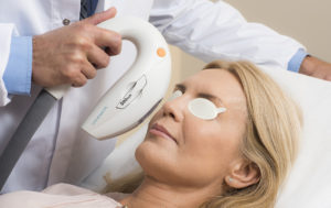 Оценка эффективности применения методики интенсивного импульсного света в комплексном лечении блефаритов и синдрома «сухого глаза» с дисфункцией мейбомиевых желез