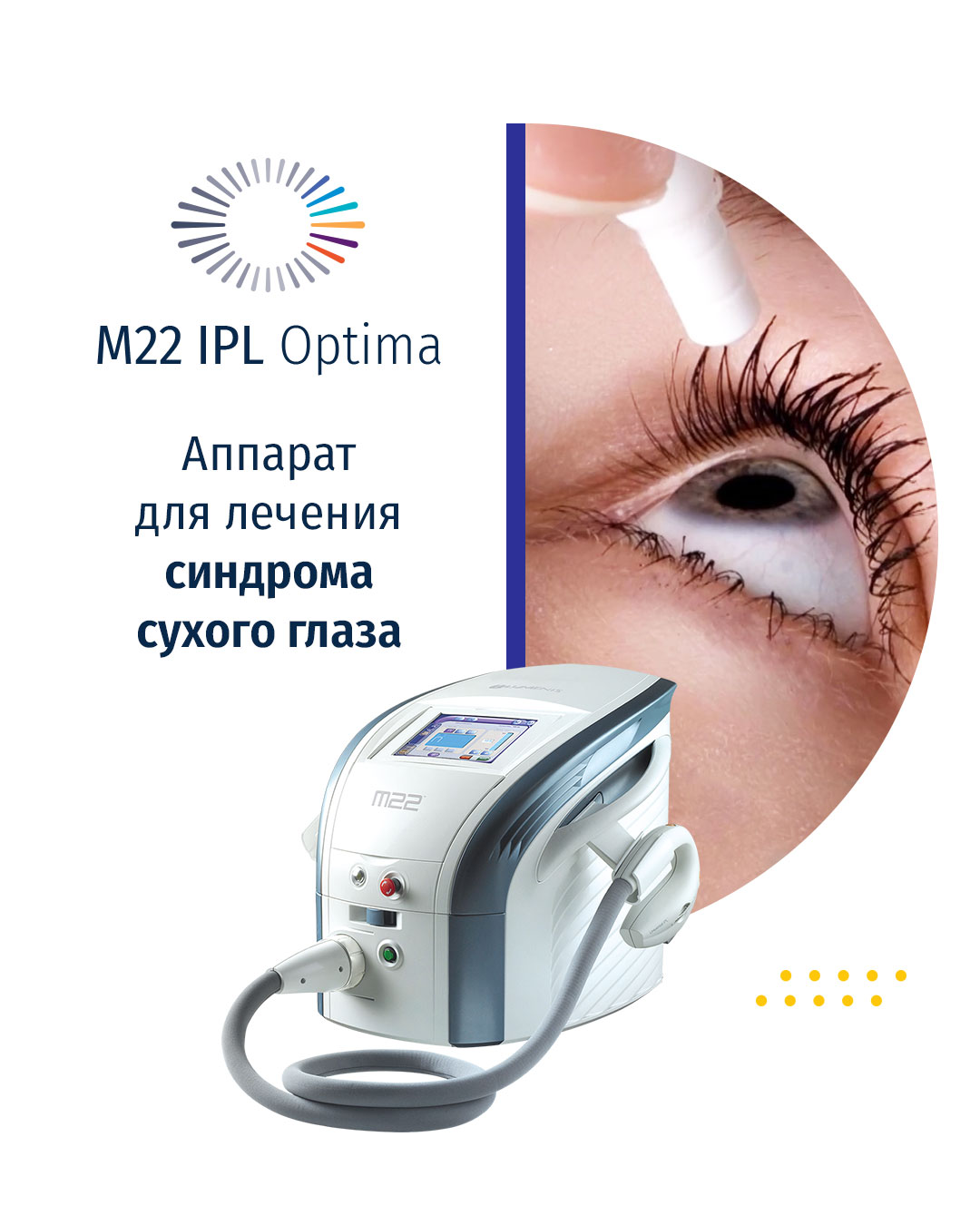 Синдром сухого глаза лечение лазером