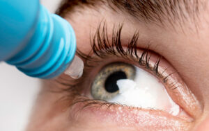 IPL М22 для лечения болезни сухого глаза