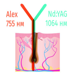 BLEND X - смешивание александрита и неодима в одном импульсе